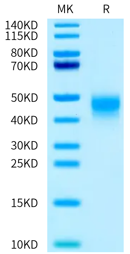 Mouse IL-4 R alpha on Tris-Bis PAGE under reduced condition. The purity is greater than 95%.Recombinant Mouse IL-4 R alpha/CD124 Protein