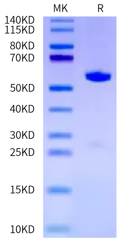Mouse ITK on Tris-Bis PAGE under reduced condition. The purity is greater than 95%.Recombinant Mouse ITK Protein