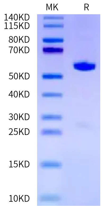 Mouse ITK on Tris-Bis PAGE under reduced condition. The purity is greater than 95%.Recombinant Mouse ITK Protein