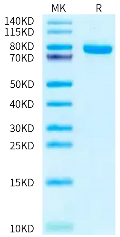 Human NRG1 Beta 1 on Tris-Bis PAGE under reduced condition. The purity is greater than 95%.Recombinant Human NRG1 Beta 1 Protein, Active
