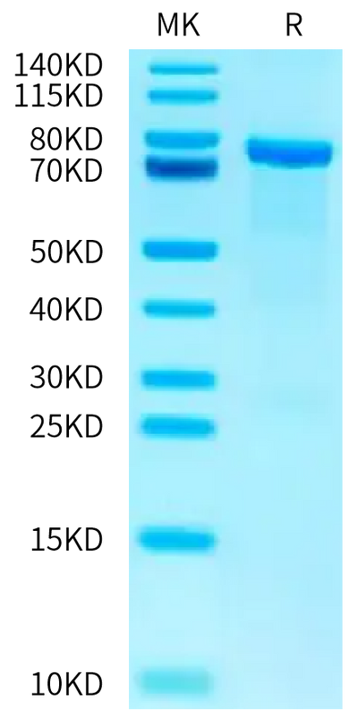 Human AKT2 on Tris-Bis PAGE under reduced condition. The purity is greater than 95%.Recombinant Human AKT2 Protein