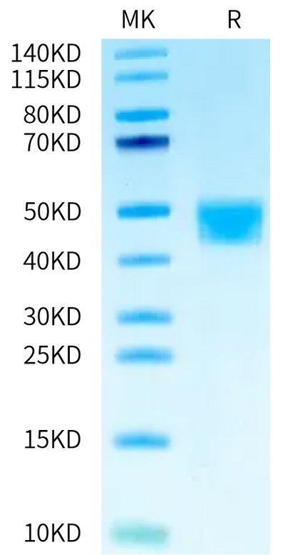 Cynomolgus MSLN on Tris-Bis PAGE under reduced condition. The purity is greater than 95%.Recombinant Cynomolgus MSLN/Mesothelin Protein, Active