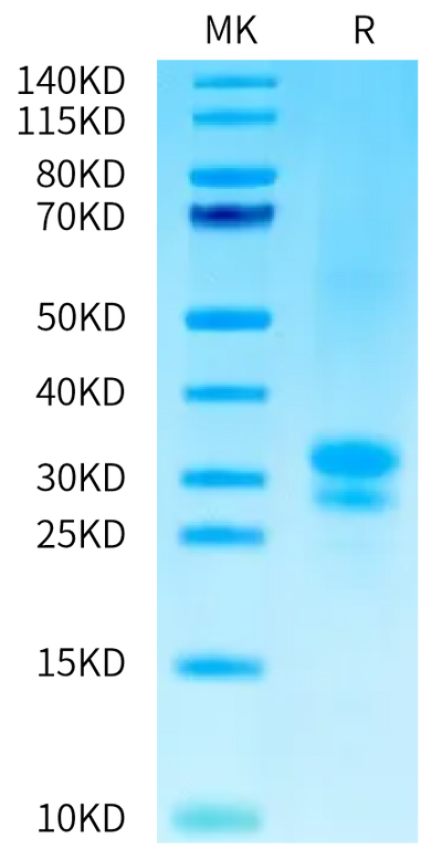 Biotinylated Human TNFSF15 on Tris-Bis PAGE under reduced condition. The purity is greater than 95%.Biotinylated Human TNFSF15 Protein (Primary Amine Labeling), Active