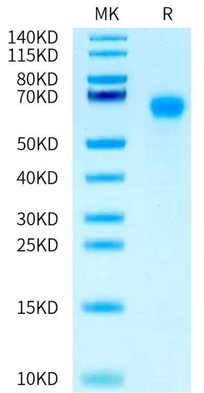 Mouse IL-6 R alpha on Tris-Bis PAGE under reduced condition. The purity is greater than 95%.Recombinant Mouse IL-6 R alpha/CD126 Protein