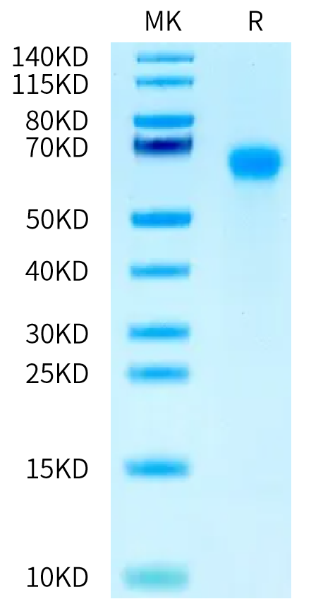 Mouse IL-6 R alpha on Tris-Bis PAGE under reduced condition. The purity is greater than 95%.Recombinant Mouse IL-6 R alpha/CD126 Protein