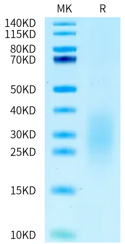Human ALK-7 on Tris-Bis PAGE under reduced condition. The purity is greater than 95%.Recombinant Human ALK-7 Protein