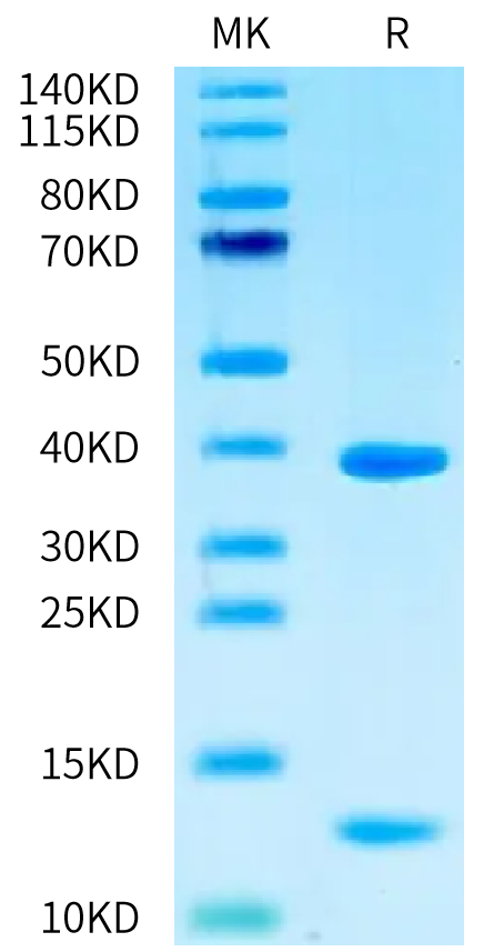 Human HLA-A*02:01&B2M&WT-1 (RMFPNAPYL) Monomer on Tris-Bis PAGE under reduced condition. The purity is greater than 95%.Recombinant Human HLA-A*02:01&B2M&WT-1 (RMFPNAPYL) Monomer Protein, Active