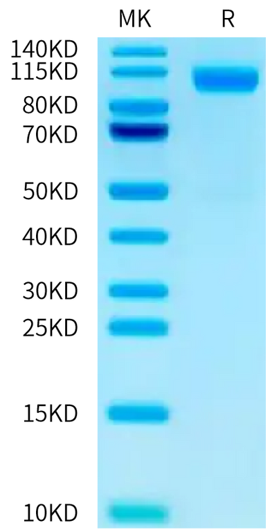 Cynomolgus CDH17 on Tris-Bis PAGE under reduced condition. The purity is greater than 95%.Recombinant Cynomolgus CDH17/Cadherin 17 Protein, Active