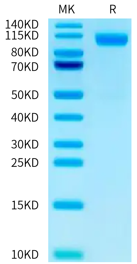 Cynomolgus CDH17 on Tris-Bis PAGE under reduced condition. The purity is greater than 95%.Recombinant Cynomolgus CDH17/Cadherin 17 Protein, Active