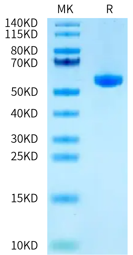 Human HLA-A*11:01&B2M&HPV16 E7 (IVCPICSQK) Monomer on Tris-Bis PAGE under reduced condition. The purity is greater than 95%.Recombinant Human HLA-A*11:01&B2M&HPV16 E7 (IVCPICSQK) Monomer Protein
