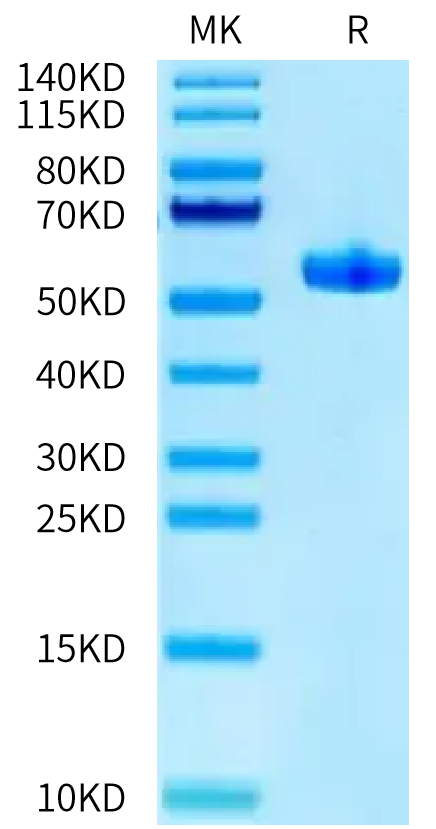 Biotinylated Human HLA-A*11:01&B2M&HPV16 E7 (IVCPICSQK) Monomer on Tris-Bis PAGE under reduced condition. The purity is greater than 95%.Biotinylated Human HLA-A*11:01&B2M&HPV16 E7 (IVCPICSQK) Monomer Protein