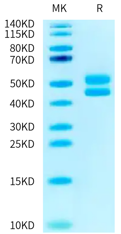 Human CD3E&CD3D on Tris-Bis PAGE under reduced condition. The purity is greater than 95%.Recombinant Human CD3E&CD3D/CD3 epsilon&CD3 delta Protein, Active