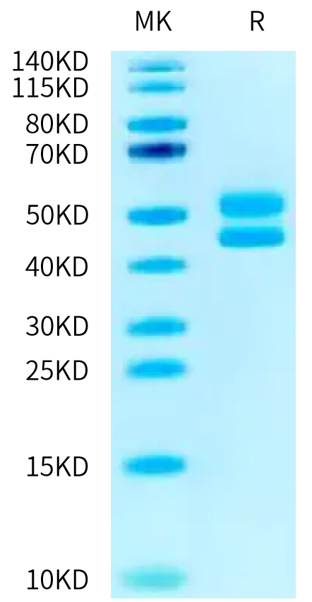 Human CD3E&CD3D on Tris-Bis PAGE under reduced condition. The purity is greater than 95%.Recombinant Human CD3E&CD3D/CD3 epsilon&CD3 delta Protein, Active