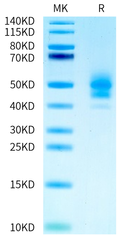 Human PSCA on Tris-Bis PAGE under reduced condition. The purity is greater than 95%.