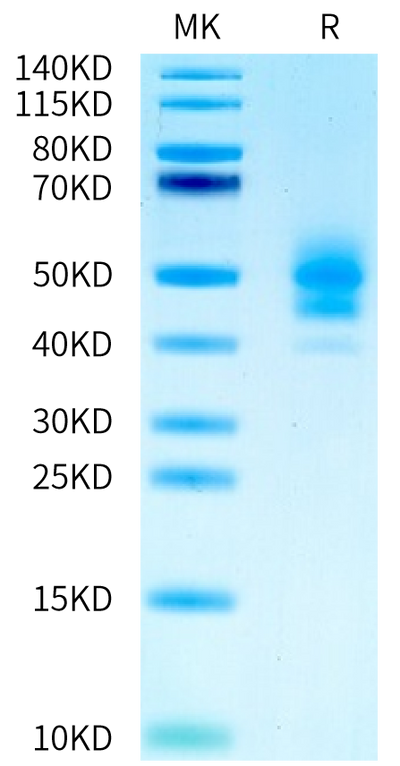 Human PSCA on Tris-Bis PAGE under reduced condition. The purity is greater than 95%.Recombinant Human PSCA-Protein, Active