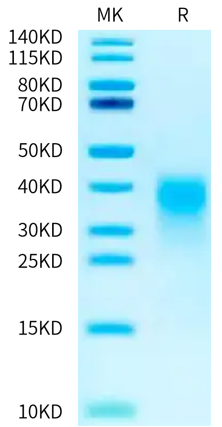 Biotinylated Human Activin RIIB on Tris-Bis PAGE under reduced condition. The purity is greater than 95%.Biotinylated Human Activin RIIB/ACVR2B Protein, Active