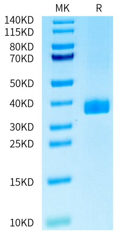 Human APOE2 on Tris-Bis PAGE under reduced condition. The purity is greater than 95%.Recombinant Human APOE2/Apolipoprotein E Protein, Active