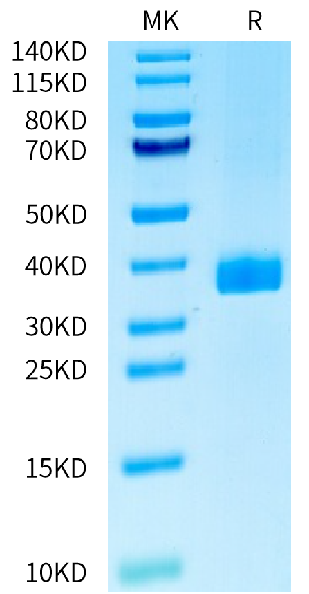 Human APOE2 on Tris-Bis PAGE under reduced condition. The purity is greater than 95%.Recombinant Human APOE2/Apolipoprotein E Protein, Active