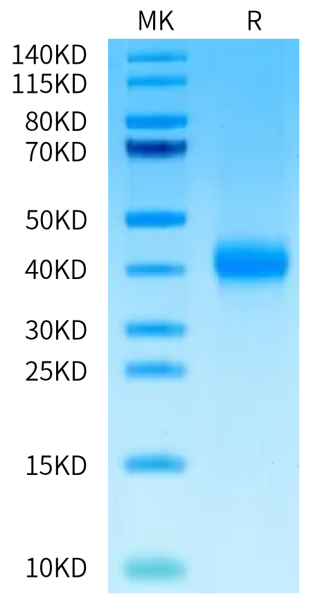 Cynomolgus ASGR1 on Tris-Bis PAGE under reduced condition. The purity is greater than 95%.Recombinant Cynomolgus ASGR1 Protein