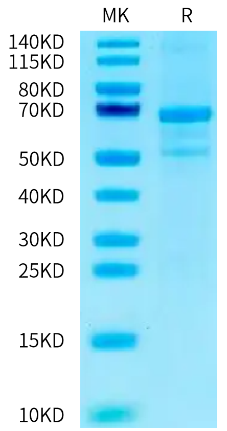 Human MVK on Tris-Bis PAGE under reduced condition. The purity is greater than 90%.Recombinant Human MVK Protein