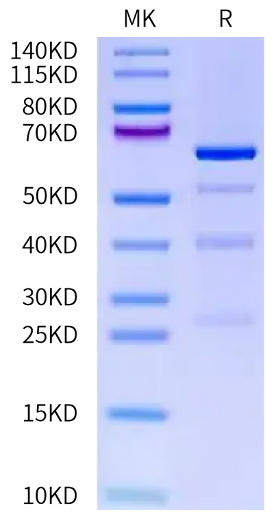 Human TRIB3 on Tris-Bis PAGE under reduced condition. The purity is greater than 90%.Recombinant Human TRIB3 Protein