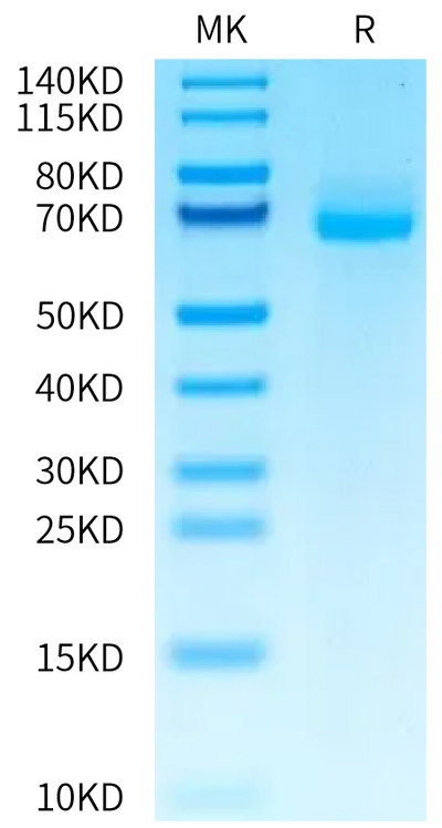 Human ALPL on Tris-Bis PAGE under reduced condition. The purity is greater than 95%.Recombinant Human ALPL Protein