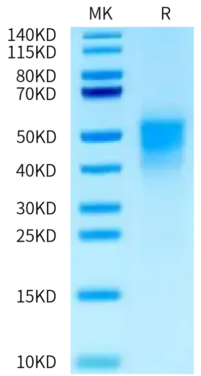 Mouse uPAR Domain (2+3) on Tris-Bis PAGE under reduced condition. The purity is greater than 95%.Recombinant Mouse uPAR/PLAUR Domain (2+3) Protein