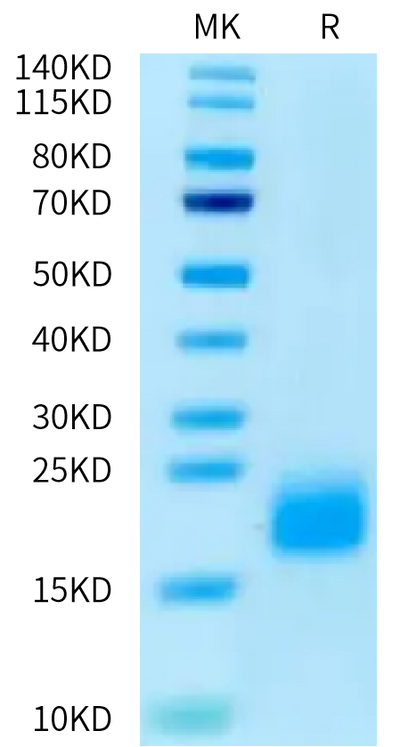 Human ACVR1B on Tris-Bis PAGE under reduced condition. The purity is greater than 95%.Recombinant Human ACVR1B/ALK-4 Protein