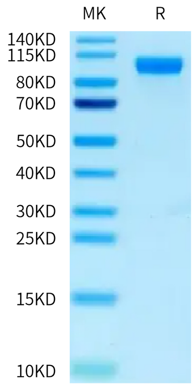 Cynomolgus CDCP1 on Tris-Bis PAGE under reduced condition. The purity is greater than 95%.Recombinant Cynomolgus CDCP1 Protein, Active