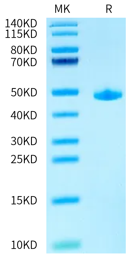 Human ACVR1 on Tris-Bis PAGE under reduced condition. The purity is greater than 95%.Recombinant Human ACVR1/ALK-2 Protein