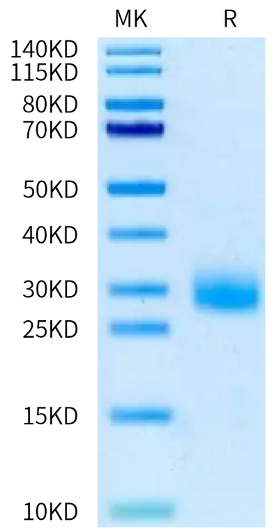 Canine IL-31 on Tris-Bis PAGE under reduced condition. The purity is greater than 95%.Recombinant Canine IL-31 Protein