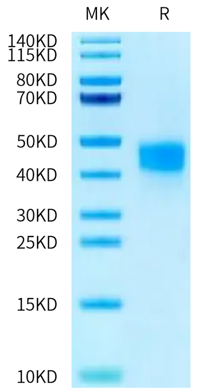 Human Fc gamma RIIIB (NA1) on Tris-Bis PAGE under reduced condition. The purity is greater than 95%.Recombinant Human Fc gamma RIIIB/CD16b (NA1) Protein, Active