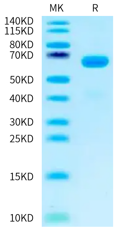 Human ASGR1 on Tris-Bis PAGE under reduced condition. The purity is greater than 95%.Recombinant Human ASGR1 Protein