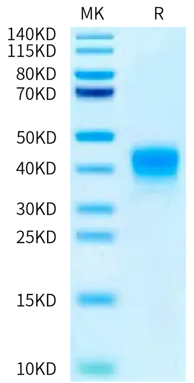 Biotinylated Human ASGR1 on Bis-Tris PAGE under reduced condition. The purity is greater than 95%.Biotinylated Human ASGR1 Protein