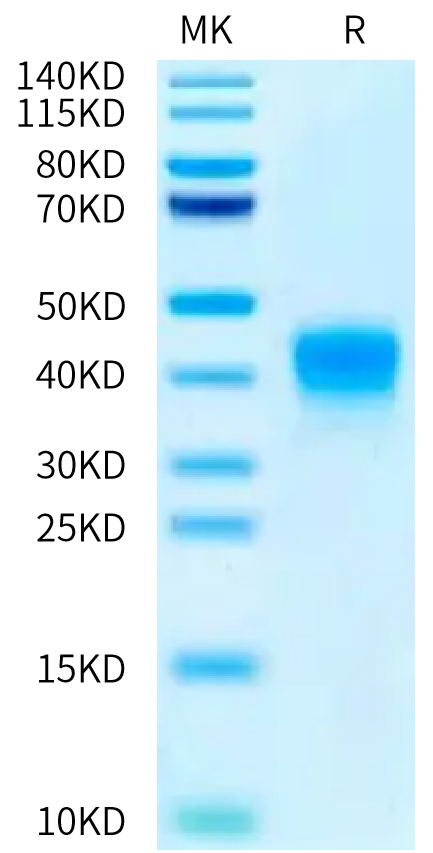 Biotinylated Human ASGR1 on Bis-Tris PAGE under reduced condition. The purity is greater than 95%.Biotinylated Human ASGR1 Protein