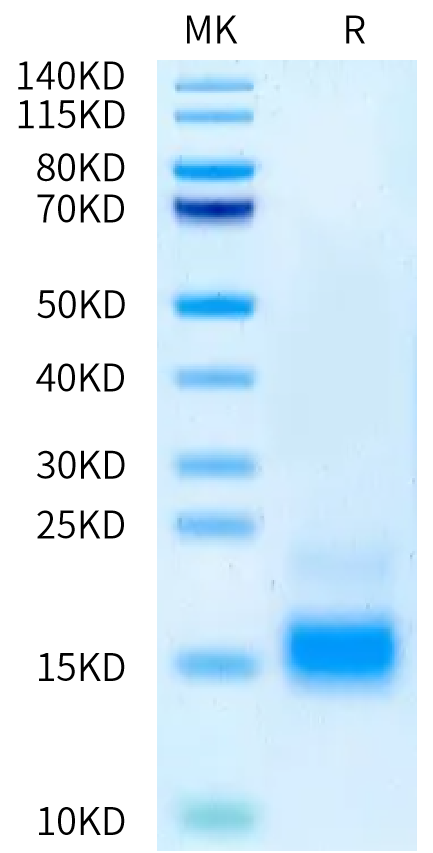 Human Beta-NGF on Tris-Bis PAGE under reduced condition. The purity is greater than 95%.Recombinant Human Beta-NGF Protein
