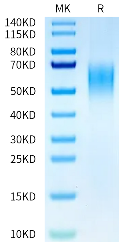 Mouse B7-2 on Tris-Bis PAGE under reduced condition. The purity is greater than 95%.Recombinant Mouse B7-2/CD86 Protein, Active