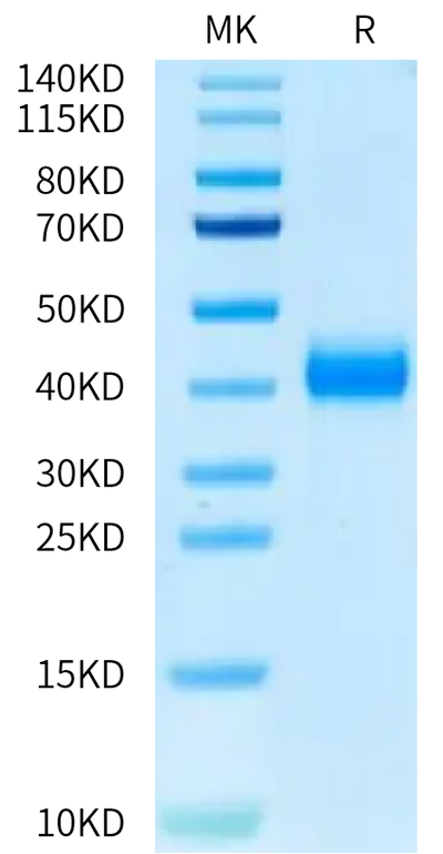 Cynomolgus CD161 on Tris-Bis PAGE under reduced condition. The purity is greater than 95%.