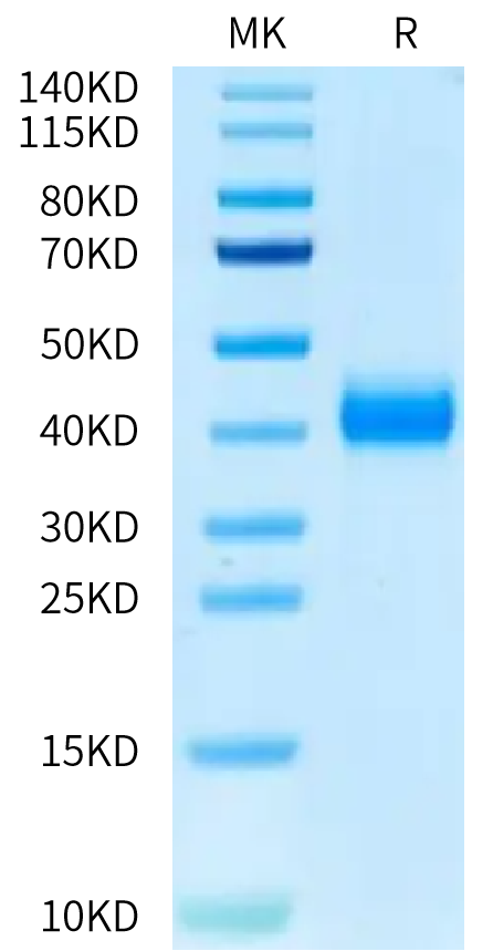 Cynomolgus CD161 on Tris-Bis PAGE under reduced condition. The purity is greater than 95%.Recombinant Cynomolgus CD161 Protein, Active