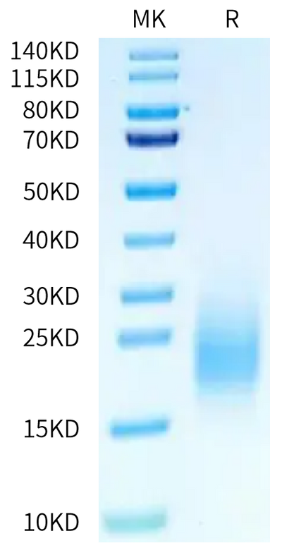 Mouse BAFFR on Tris-Bis PAGE under reduced condition. The purity is greater than 95%.Recombinant Mouse BAFFR/TNFRSF13C Protein, Active