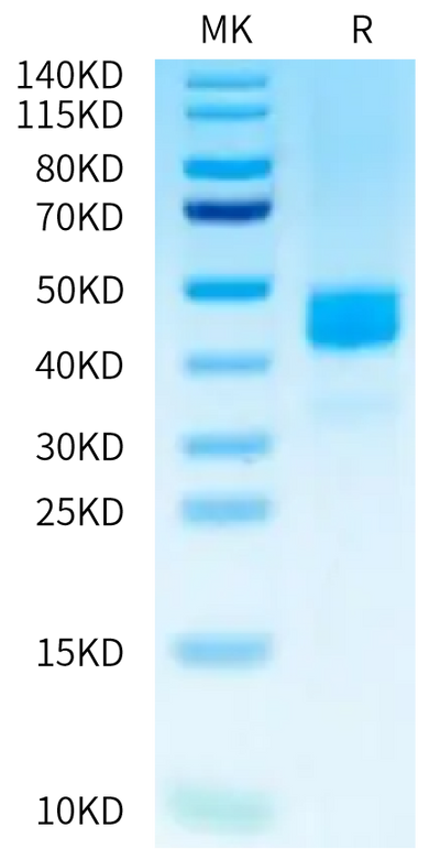 Human CD229 on Tris-Bis PAGE under reduced condition. The purity is greater than 95%.Recombinant Human CD229/SLAMF3 Protein