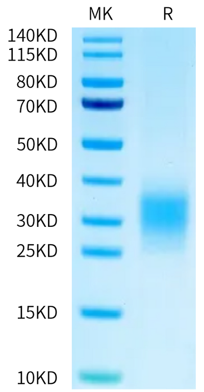 Mouse uPAR Domain 3 on Bis-Tris PAGE under reduced condition. The purity is greater than 95%.Recombinant Mouse uPAR/PLAUR Domain 3 Protein