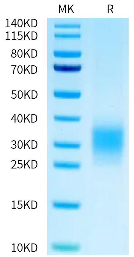 Mouse uPAR Domain 3 on Bis-Tris PAGE under reduced condition. The purity is greater than 95%.Recombinant Mouse uPAR/PLAUR Domain 3 Protein