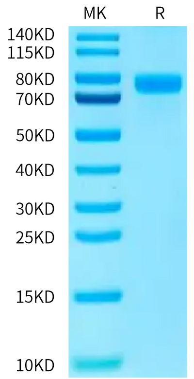 Human Nectin-1 on Bis-Tris PAGE under reduced condition. The purity is greater than 95%.Recombinant Human Nectin-1/PVRL1/CD111 Protein, Active
