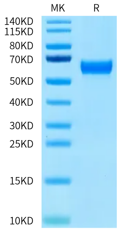 Human IL-3 R Beta on Tris-Bis PAGE under reduced condition. The purity is greater than 95%.Recombinant Human IL-3 R Beta/CD131 Protein