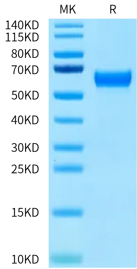 Human IL-3 R Beta on Tris-Bis PAGE under reduced condition. The purity is greater than 95%.Recombinant Human IL-3 R Beta/CD131 Protein