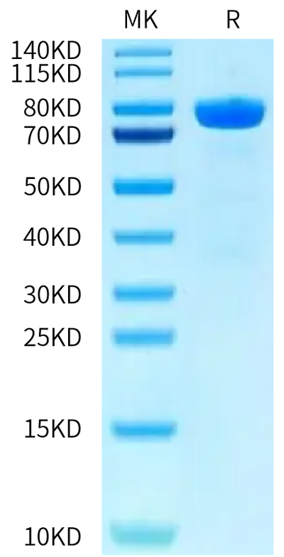 Human CDH10 on Tris-Bis PAGE under reduced condition. The purity is greater than 95%.Recombinant Human CDH10/Cadherin-10 Protein