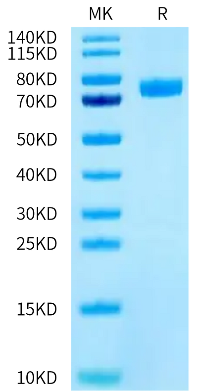 Human CD14 on Tris-Bis PAGE under reduced condition. The purity is greater than 95%.Recombinant Human CD14 Protein