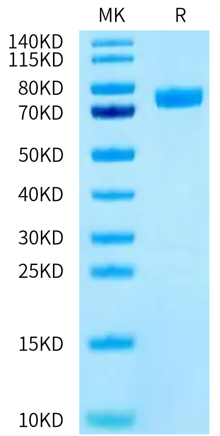 Human CD14 on Tris-Bis PAGE under reduced condition. The purity is greater than 95%.Recombinant Human CD14 Protein