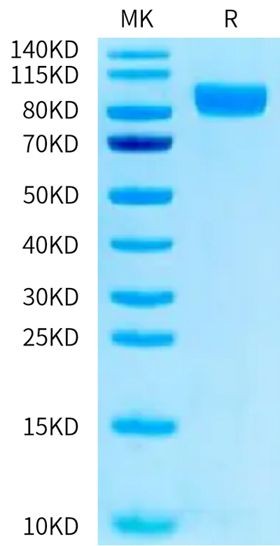 Human Nectin-3 on Tris-Bis PAGE under reduced condition. The purity is greater than 95%.Recombinant Human Nectin-3/CD113 Protein, Active